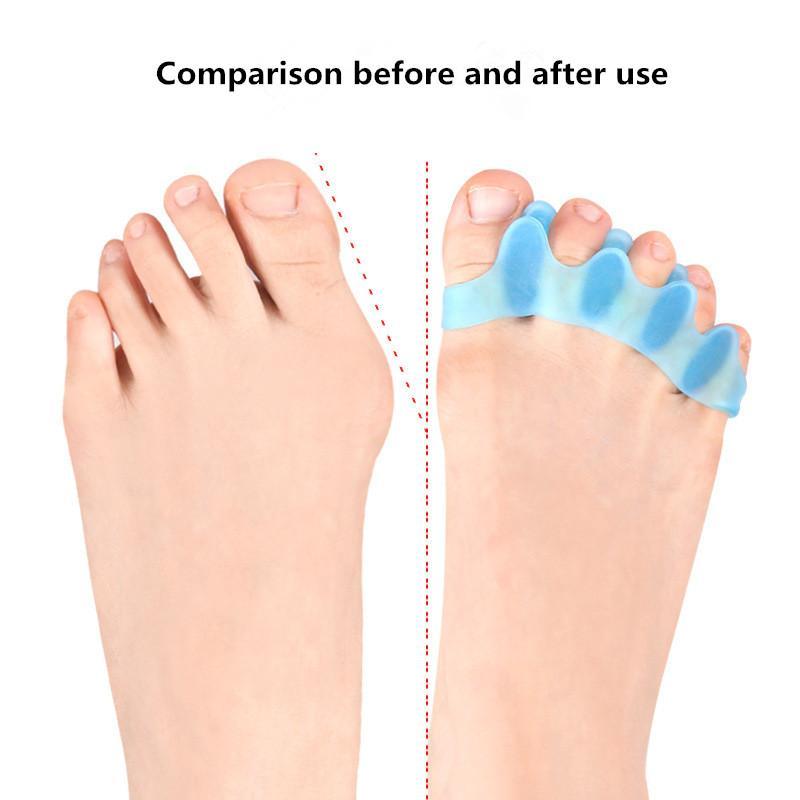 Soft Gel Toe Separators, 1 Pair Big Toe Spacers, Toe Cushion Pads for Daily Use, Foot Care Product for Adult & Kids